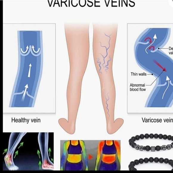 Anti swelling black obsidian stretch stone bracelet. - Picture 5 of 8